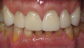 Smile Gallery - After