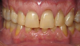 Smile Gallery - Before